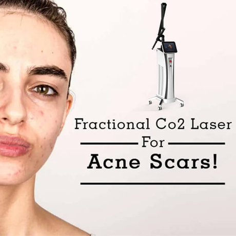 co2 fractional laser machine-3.jpg
