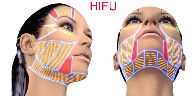 hifu skin rejuvenation machine-3
