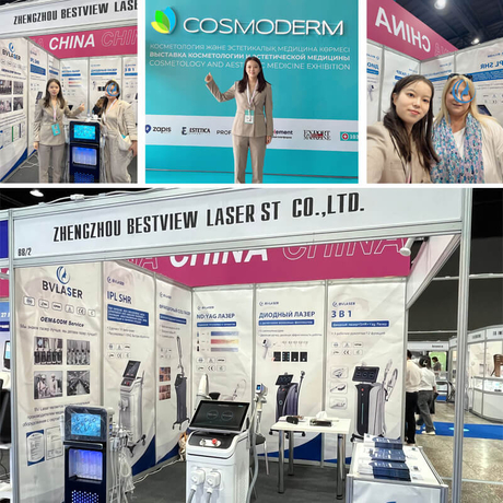 Bestview Laser-5.jpg