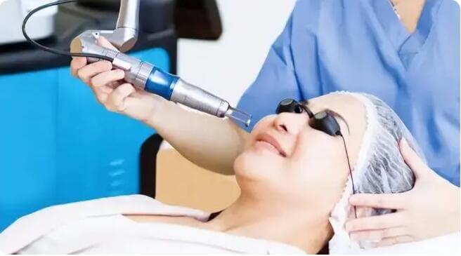 fractional carbon dioxide laser therapy