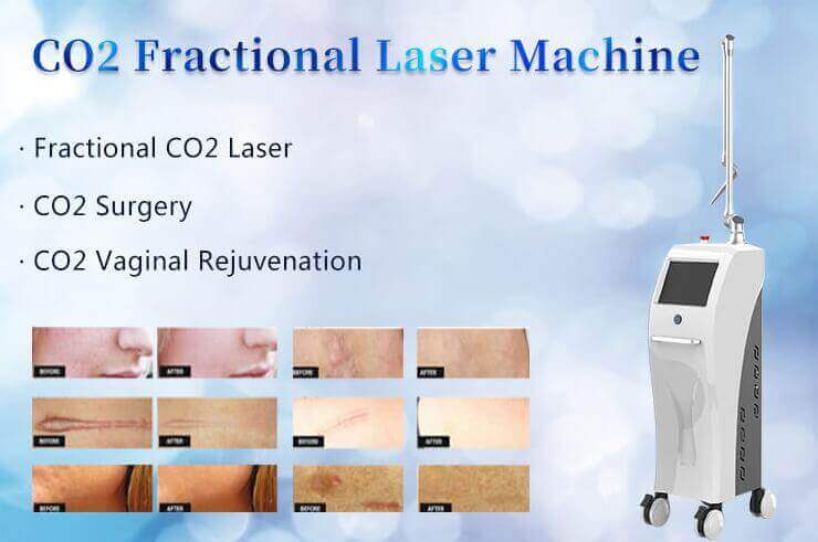 co2 fractional laser machinery